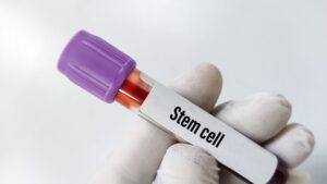 Person holding a test tube with liquid in it labeled "Stem Cell."